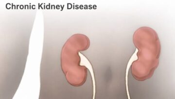 kidney-17122025
