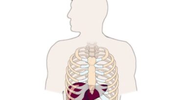 Liver Biopsy-122007