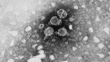 Hepatitis_B_virus_01 Hepatitis_B_virus_01