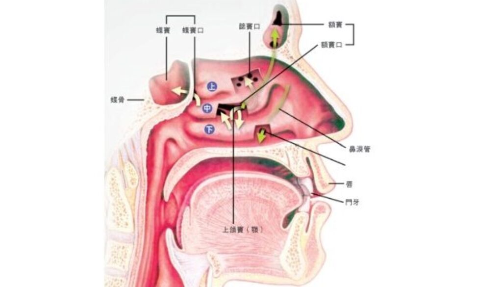 Sinusitis-032007-2 (2)