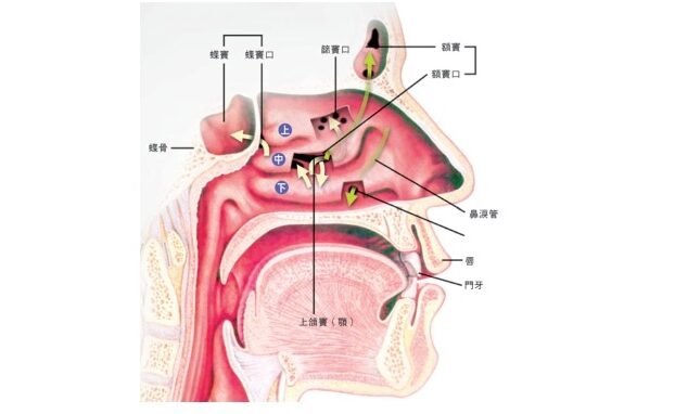 Sinusitis-032007-2 (2)