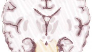 ad-012004-a