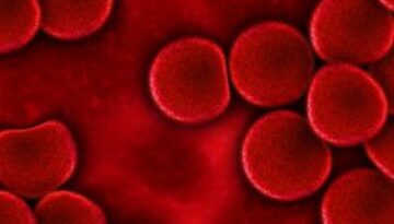 blood-75302_1280