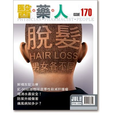 ISSUE 170 脱发 ── 男女各不同