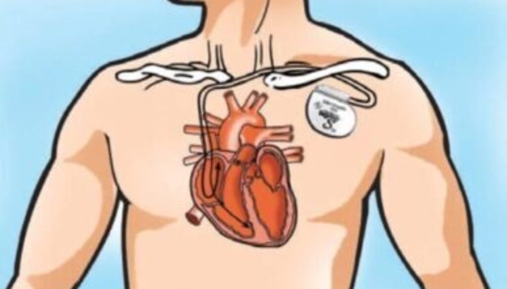 cardio-122004-4a