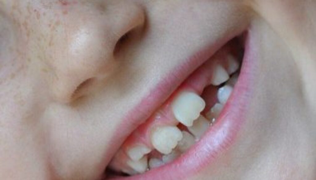 dental-032003-a