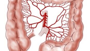 ibs