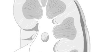 kidney-062014