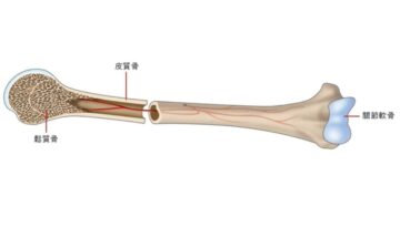 osteoporosis-122007