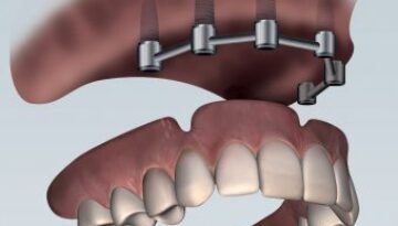 dental-032011