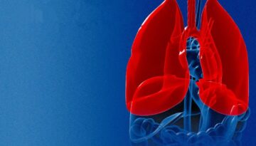 tuberculosis-092007-1