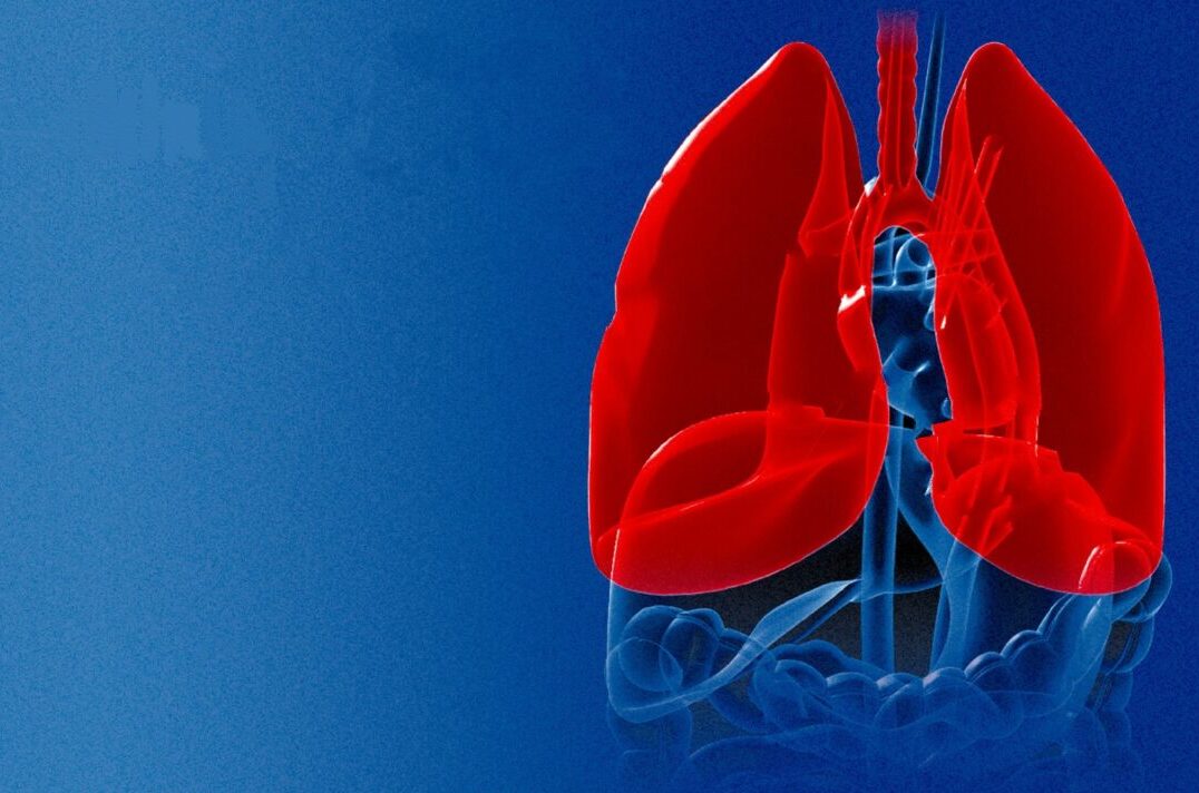 tuberculosis-092007-1