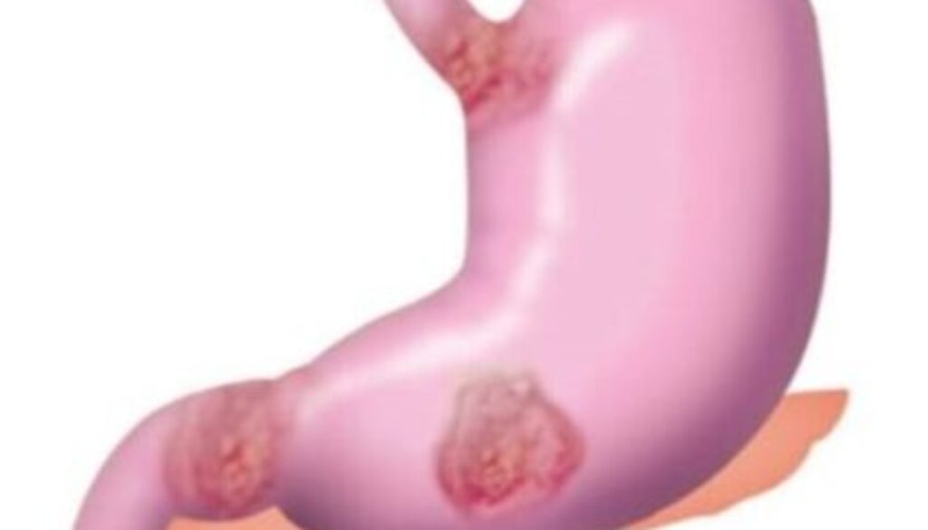 stomach-3